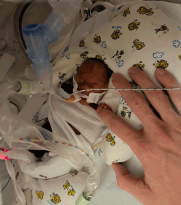 A photo of a baby born at 24 weeks gestation. He is attached to several pieces of medical equipment and he is holding the tip of his parent's finger for scale.